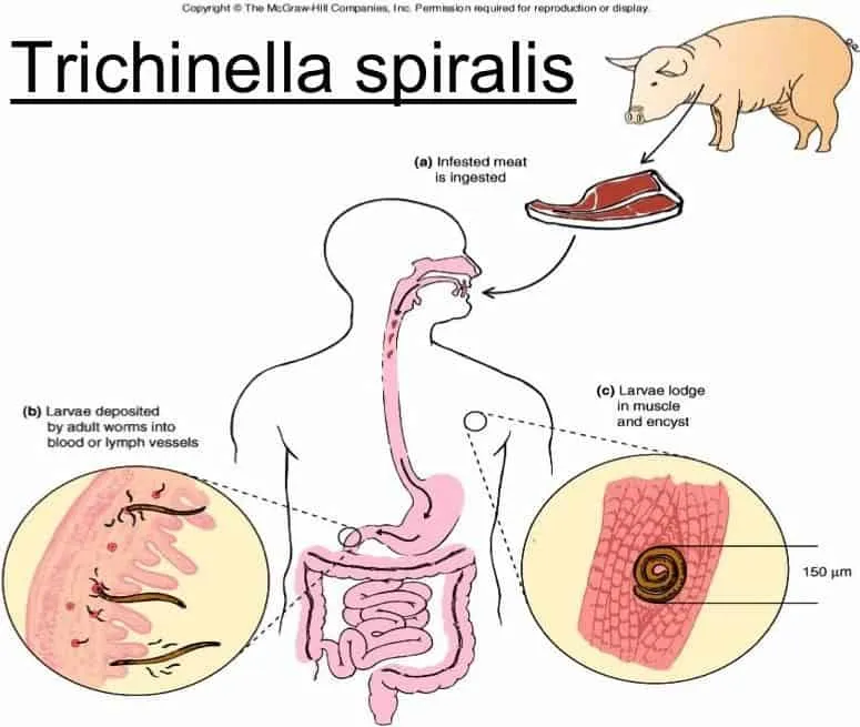 trichinella infographic